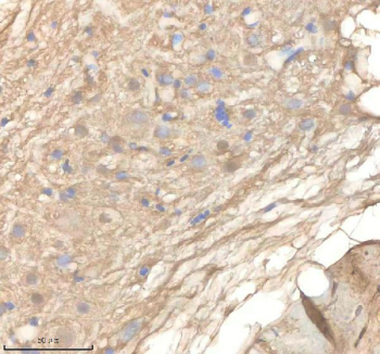IHC staining of zebrafish Ppm1g protein using Zebrafish Ppm1g antibody, HRP-labeled secondary and DAB substrate. Ppm1g was detected in a paraffin-embedded section of zebrafish brain tissue. HIER: boil tissue sections in pH8 EDTA for 20 min and allow to cool before testing.
