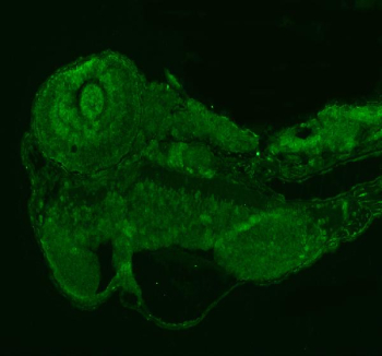 Immunofluorescent staining of PRPF6 protein using Zebrafish PRPF6 antibody (green). HIER: steam section in pH8 EDTA buffer for 20 min.