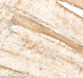 IHC staining of FFPE zebrafish muscle tissue with Psmb1 antibody, HRP-labeled secondary and DAB substrate. HIER: boil tissue sections in pH8 EDTA for 20 min and allow to cool before testing.