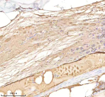 IHC staining of FFPE zebrafish spinal tissue with Rab14 antibody, HRP-labeled secondary and DAB substrate. HIER: boil tissue sections in pH8 EDTA for 20 min and allow to cool before testing.