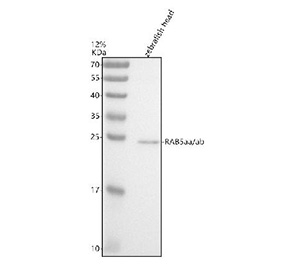 Western blot analysis of Rab5aa/ab protein using Zebrafish RAB5aa/ab antibody and zebrafish head tissue lysates. Predicted molecular weight ~23 kDa.