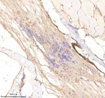 IHC staining of FFPE zebrafish spinal cord tissue with Rcc2 antibody, HRP-labeled secondary and DAB substrate. HIER: boil tissue sections in pH8 EDTA for 20 min and allow to cool before testing.