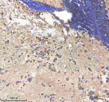 IHC staining of FFPE zebrafish brain tissue with Shha antibody, HRP-labeled secondary and DAB substrate. HIER: boil tissue sections in pH8 EDTA for 20 min and allow to cool before testing.
