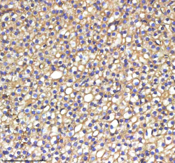 IHC staining of zebrafish Srebf1 protein using Zebrafish Srebf1 antibody, HRP-labeled secondary and DAB substrate. Srebf1 was detected in a paraffin-embedded section of zebrafish liver tissue. HIER: boil tissue sections in pH8 EDTA for 20 min and allow to cool before testing.