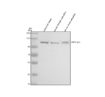 Western blot analysis of Xpo1a/b protein using Zebrafish Xpo1 antibody and 1) zebrafish head, 2) whole female zebrafish, 3) whole male zebrafish tissue lysate. Predicted molecular weight ~123 kDa.