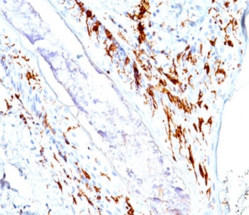 CD1a antibody immunohistochemistry
