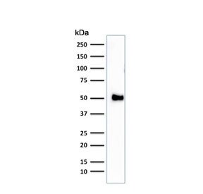 Western blot testing of human Jurkat cell lysate with CD2 antibody (clone 1E7E8.G4). Expected molecular weight: 38-50 kDa depending on level of glycosylation.