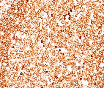 IHC testing of FFPE human tonsil (10X) stained with CD79a antibody cocktail (clone JCB117 + HM47/A9).