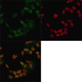 Immunofluorescent staining of methanol-fixed human MCF7 cells with ER antibody (clone ER506, green) and Reddot nuclear stain (red).