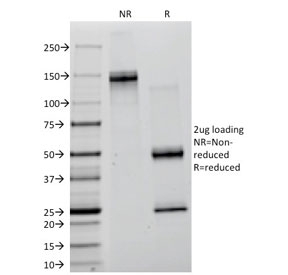 SDS-PAGE analysis of purified, BSA-free Lambda Light Chain antibody (clone ICO-106) as confirmation of integrity and purity.