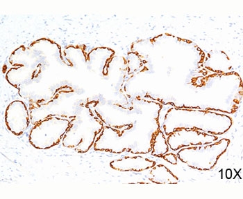 Cytokeratin 14 antibody LL002 immunohistochemistry prostate 10X