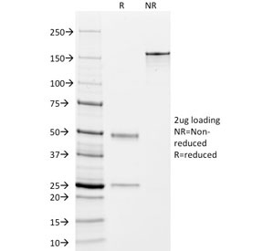 SDS-PAGE analysis of purified, BSA-free DOG1 antibody (clone DG1/447) as confirmation of integrity and purity.