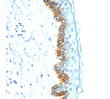 Acidic Cytokeratin antibody AE1 immunohistochemistry skin