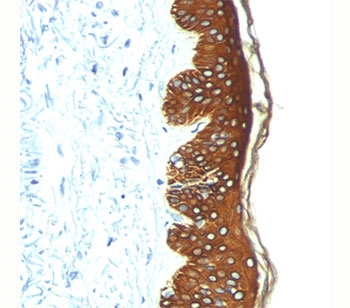 Basic Cytokeratin antibody AE3 immunohistochemistry skin