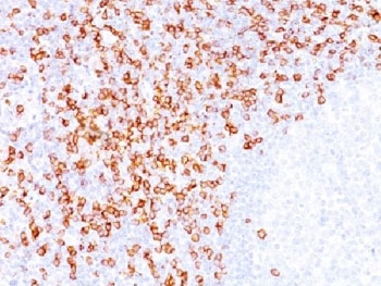IHC testing of FFPE tonsil tissue with CD8 antibody (clone C8/144B).