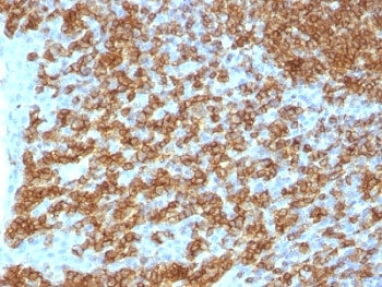 IHC test of FFPE human tonsil probed with CD45RA antibody