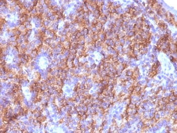 IHC: Formalin-fixed, paraffin-embedded parathyroid stained with Chromogranin A antibody (CGA/413 + CHGA/777 + CHGA/798)