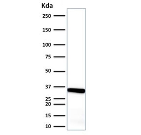 Western blot testing of human endometrium tissue lysate with Calponin antibody. Predicted molecular weight ~34 kDa.