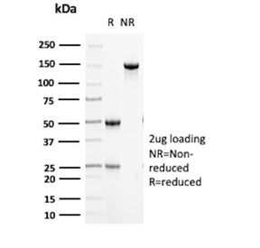 SDS-PAGE analysis of purified, BSA-free CD16 antibody (clone ICO-116) as confirmation of integrity and purity.