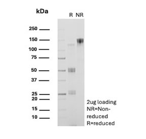 SDS-PAGE analysis of purified, BSA-free CD13 antibody (clone B-F10) as confirmation of integrity and purity.