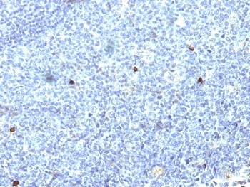 IHC: Formalin-fixed, paraffin-embedded human tonsil stained with HLA-Aw32 / HLA-A25 antibody (SPM418).