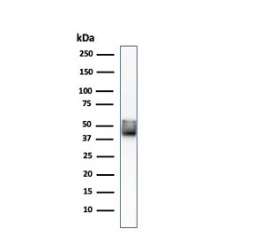 Western blot testing of human HCT-116 cell lysate with Keratin 8 antibody (clone KRT8/803).