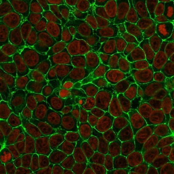 Immunofluorescent staining of human MCF7 cells with anti-EpCAM antibody (clone SPM134, green) and Reddot nuclear stain (red).