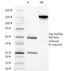 SDS-PAGE Analysis of Purified, BSA-Free MUC5AC Antibody (clone 2-11M1). Confirmation of Integrity and Purity of the Antibody.