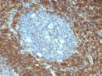 IHC: Formalin-fixed, paraffin-embedded human tonsil stained with Bcl-2 antibody (BCL2/796).