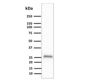 Western blot testing of human brain lysate with UchL1 antibody (clone UCHL1/841). Predicted molecular weight ~25 kDa.