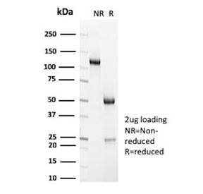 SDS-PAGE analysis of purified, BSA-free CD7 antibody (clone HuLy-m2) as confirmation of integrity and purity.
