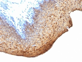 IHC analysis of formalin-fixed, paraffin-embedded human tonsil stained with Cytokeratin 10/13 antibody (clone DE-K13).