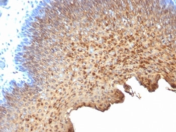IHC analysis of formalin-fixed, paraffin-embedded human tonsil stained with Cytokeratin 10/13 antibody (clone SPM262).