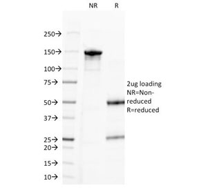 SDS-PAGE Analysis of Purified, BSA-Free Progesterone Antibody (clone 6-5E-3F). Confirmation of Integrity and Purity of the Antibody.