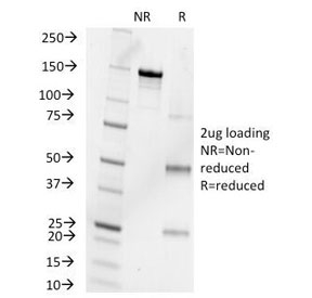 SDS-PAGE Analysis of Purified, BSA-Free Progesterone Antibody (clone 6-5E-10B). Confirmation of Integrity and Purity of the Antibody.