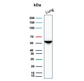 Western blot testing of human lung tissue lysate with Alpha 1 Antitrypsin antibody. Expected molecular weight: 47-52 kDa depending on the level of glycosylation.
