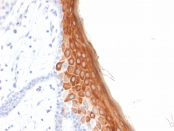 IHC testing of FFPE human skin with recombinant KRT10 antibody (clone rKRT10/844). Required HIER: boil tissue sections in pH6, 10mM citrate buffer, for 10-20 min followed by cooling at RT for 20 min.