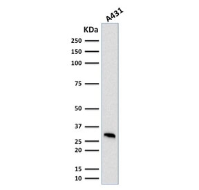Western blot testing of human A431 cell lysate with MTAP antibody (clone MTAP/1813). Expected molecular weight: 26-38 kDa (multiple isoforms).