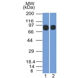 Western blot testing of human 1) Raji and 2) Ramos cell lysate with CD10 antibody (clone MME/1892). Routinely visualized at ~100 kDa. 