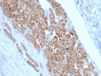 IHC staining of FFPE human adrenal gland with StAR antibody (clone STAR/2140). Required HIER: boil tissue sections in 10mM citrate buffer, pH 6, for 10-20 min followed by cooling at RT for 20 min.