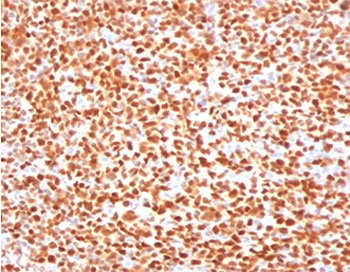 IHC testing of FFPE human tonsil with OCT-2 antibody (clone PD2F2-1). HIER: boil tissue sections in pH 9 10mM Tris with 1mM EDTA for 10-20 min followed by cooling at RT for 20 min.