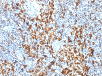 IHC testing of FFPE human lymph node with CD163 antibody (clone M130/1210). HIER: boil tissue sections in pH6, 10mM citrate buffer, for 10-20 min followed by cooling at RT for 20 min.