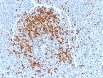 IHC testing of FFPE human tonsil tissue with ZAP70 antibody (clone TCL1/2078). HIER: boil tissue sections in pH 9 10mM Tris with 1mM EDTA for 10-20 min followed by cooling at RT for 20 min.