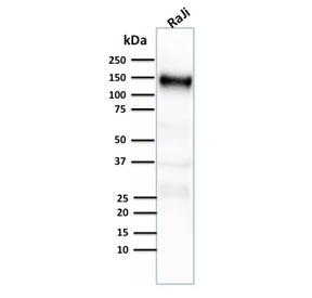 Western blot testing of human Raji cell lysate with CD21 antibody (clone CR2/2754).
