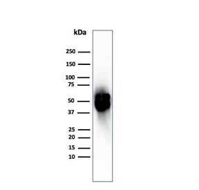 Western blot testing of human spleen tissue with recombinant Thymidine Phosphorylase antibody. Predicted molecular weight ~55 kDa.