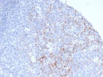 IHC staining of FFPE human tonsil tissue with CD23 antibody (clone FCER2/6888). HIER: boil tissue sections in pH 9 10mM Tris with 1mM EDTA for 20 min and allow to cool before testing.