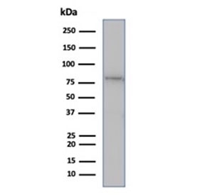 Western blot testing of human Jurkat cell lysate using MLH1 antibody (clone rMLH1/6285). Predicted molecular weight ~85 kDa.