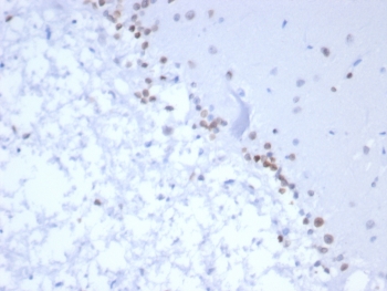 IHC staining of FFPE human brain tissue with NEUROG3 antibody (clone NGN3/1809) HIER: boil tissue sections in pH 9 10mM Tris with 1mM EDTA for 20 min and allow to cool before testing.