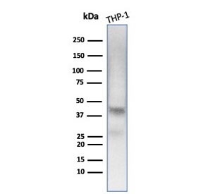 Western blot testing of human THP-1 cell lysate with Wilms Tumor 1 antibody (clone WT1/7451). Expected molecular weight 47-55 kDa.