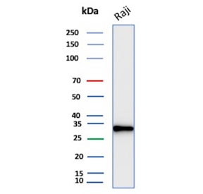 Western blot testing of human Raji cell lysate with CD20 antibody. Predicted molecular weight ~33 kDa.